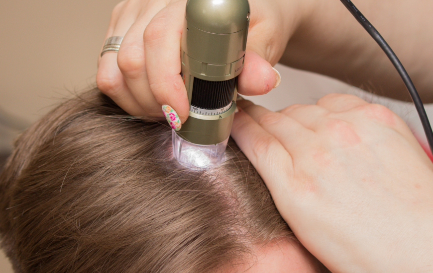 Trichoskopia – skuteczne badanie kondycji włosów.